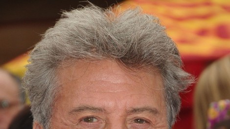 Dustin Hoffman premagal raka