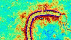 Hemoragična mrzlica ebola plaši svet!