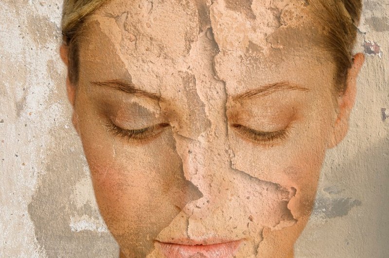 Imaš težave s suho kožo na obrazu?  (foto: Profimedia)