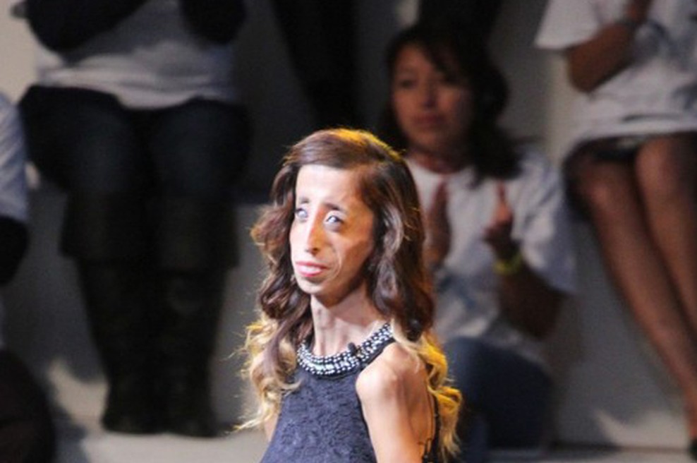 Naj te navdahne življenjska zgodba Lizzie Velasquez (foto: profimedia)