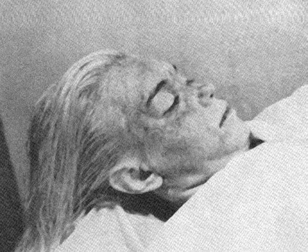 Na sliki je Marilyn po tem, ko so jo našli mrtvo, golo, v njenem stanovanju v Brentwoodu. Stara je bila …