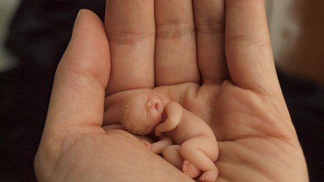 FOTO: Je to najmanjši dojenček na svetu?