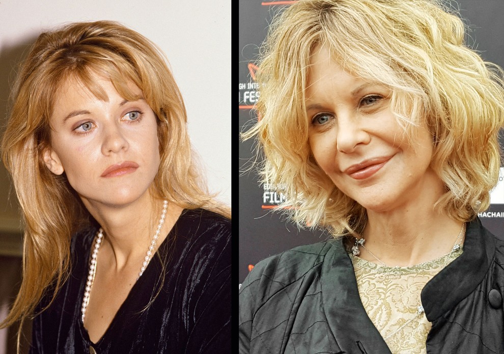 Meg Ryan: Ljubka podoba, ki smo jo pred časom spremljali v številnih romantičnih komedijah, je zdaj le še stvar spominov, …