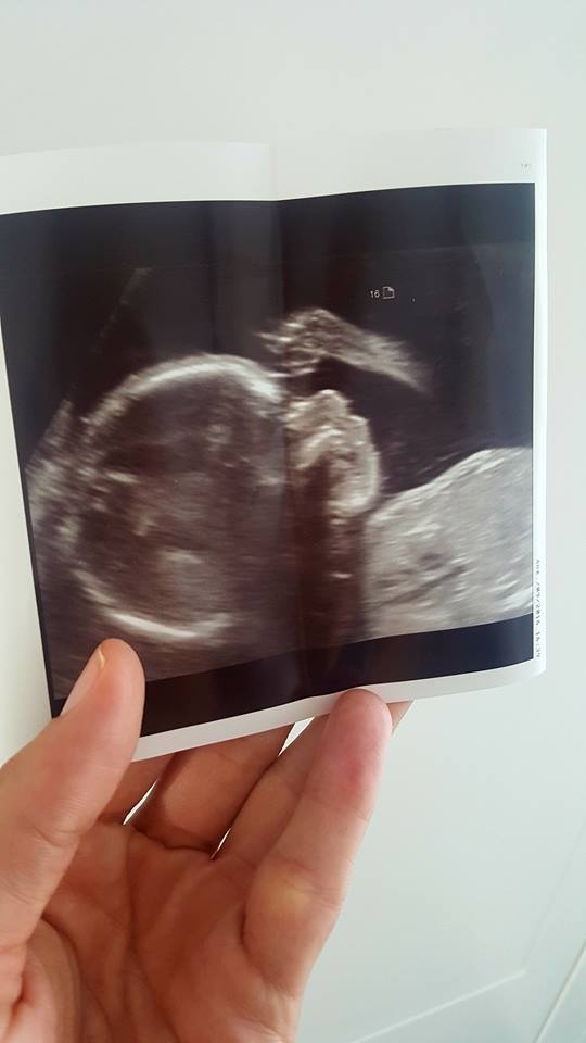Rebeka Dremelj je pred tednom dni na Facebooku presenetila z ultrazvočno fotografijo svojega drugega otroka. Ljuuuubko! Topimo se!
