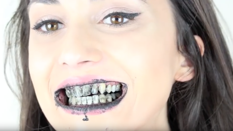 VIDEO: To je nenavaden način, s katerim bodo tvoji zobje beli kot še nikoli