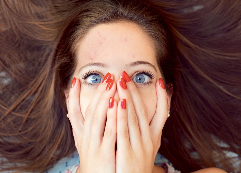Znana lepotna blogerka razkrila, kako se znebiti mozolja v enem dnevu! (foto: Getty Images)