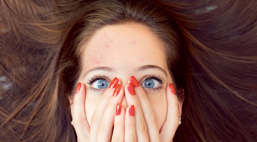 Je tvoja koža polna aken? Slovenski dermatolog želi, da veš tole! (foto: Getty Images)