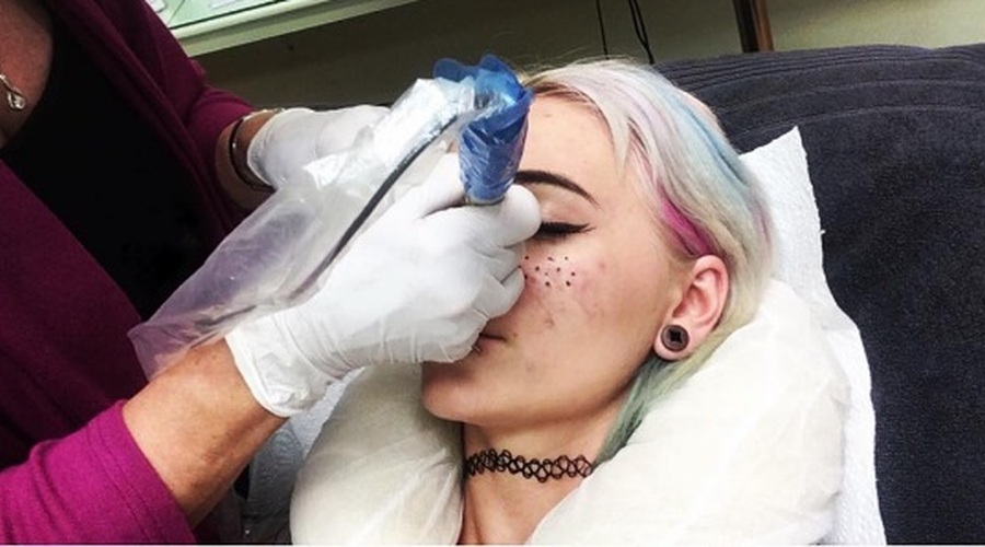Dekleta po svetu je obnorel ta NORI lepotni trend! (foto: Instagram)