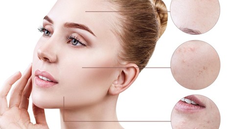 Področje aken na obrazu razkriva marsikaj o tvojem zdravju