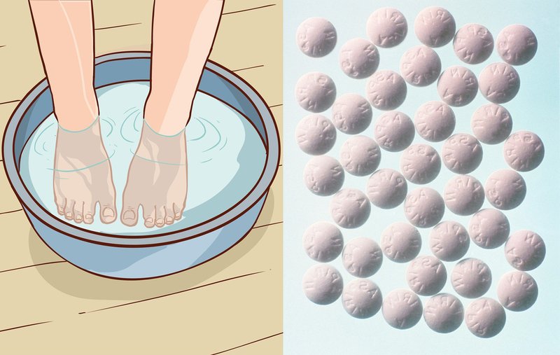 Triki z aspirinom, ki bi jih morale poznati vse ženske! (OMG, kakšni rezultati!) (foto: Profimedia)