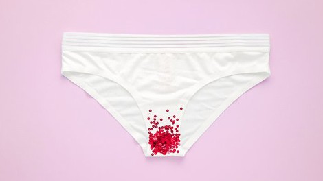 Kako z oblačil odstraniti menstrualno kri? (trik, ki VEDNO deluje)