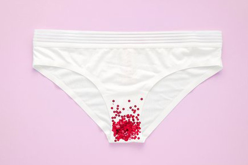 Pandemska menstruacija: Ne le cepivo, za NEREDEN cikel je lahko krivo tudi ... (foto: Shutterstock)