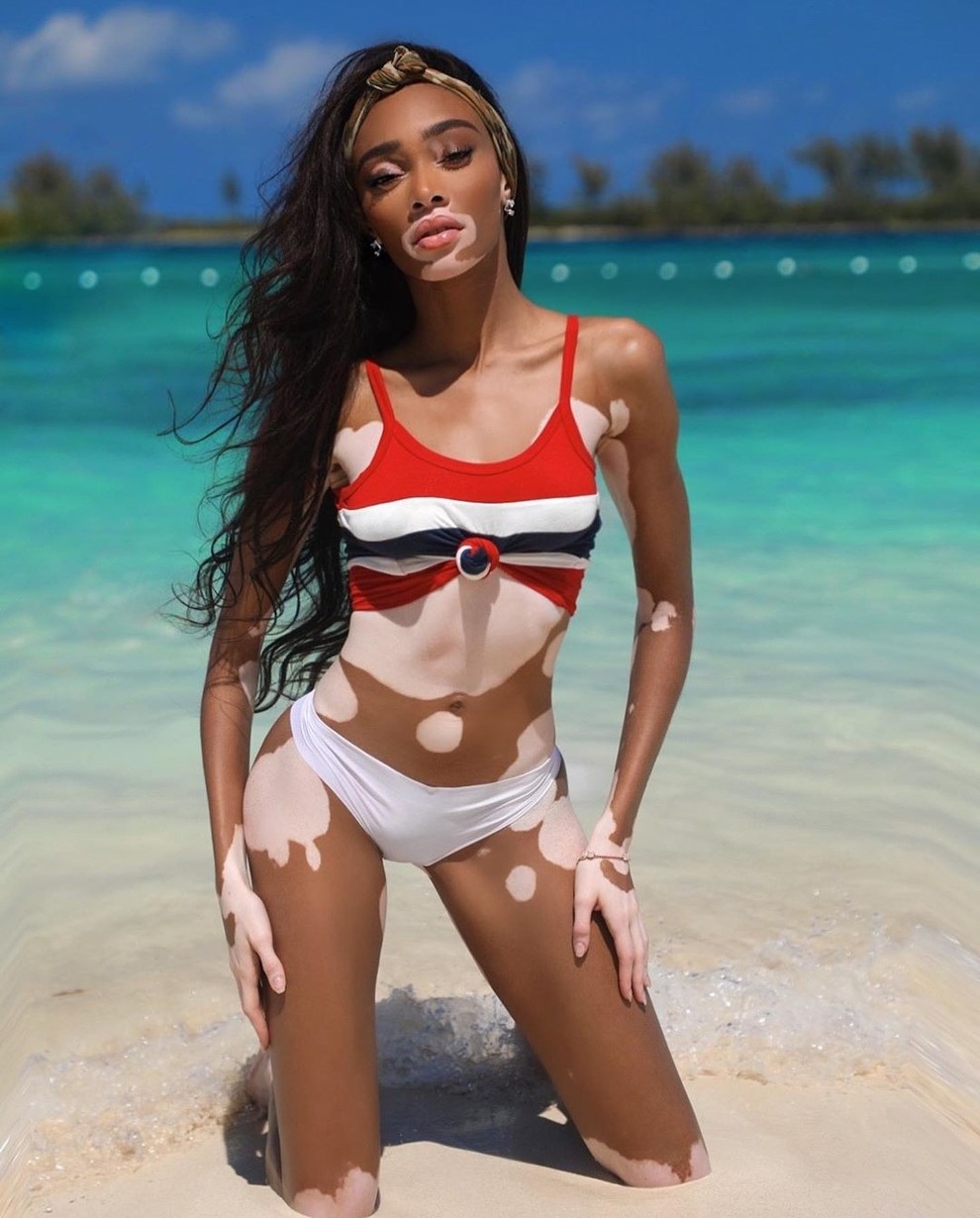 Viktorijini angelčki so namreč med sebe že preteklo jesen sprejeli prav posebno manekenko – "lisasto" lepotico Winnie Harlow, ki ima …