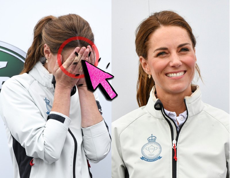 Si opazila, da Kate Middleton na rokah vedno nosi OBLIŽE? 🧐 TO je razlog ... (foto: Profimedia)