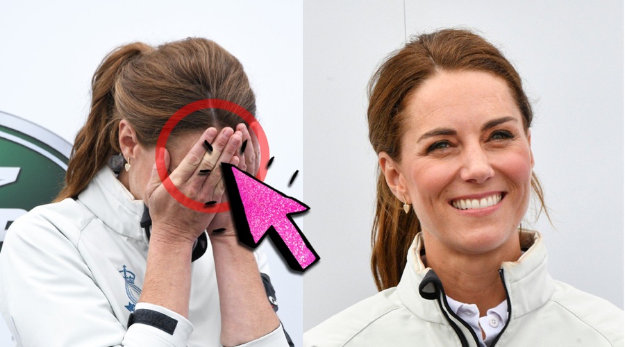 Si opazila, da Kate Middleton na rokah vedno nosi OBLIŽE? 🧐 TO je razlog ... (foto: Profimedia)
