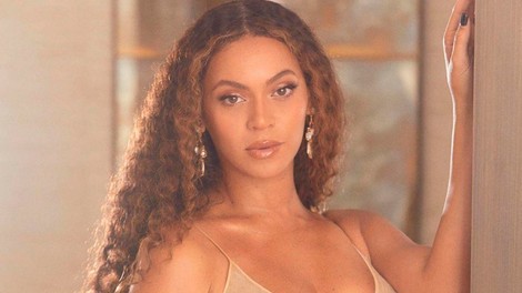 FOTO: Tako je v RESNICI videti Beyonce (brez Photoshopa in filtrov)