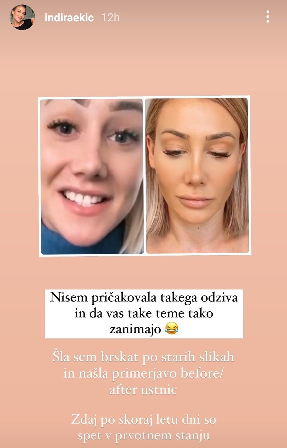 Na fotografiji je razlika sicer očitna, ampak priznamo, da če tega ne bi pokazala, skoraj ne bi opazili. 🙊 Indira …