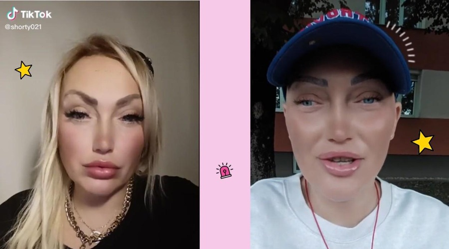 Pretresljiva zgodba TikTokerke Urške: Pred rakom doživela nesrečo, ki ji je spremenila življenje (foto: Printscreen Tik tok Shorty 021)