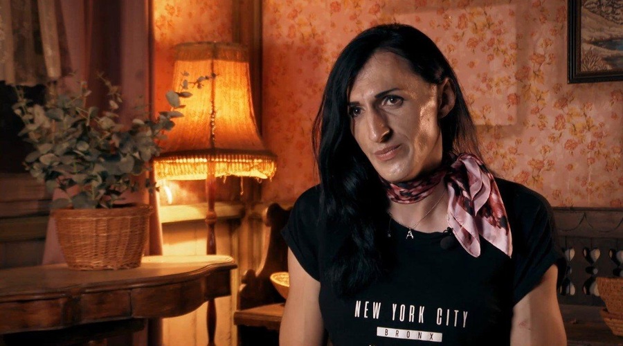 TO je edina operacija, ki jo je Andrea prestala, da je takšna, kot jo poznamo danes (foto: POP TV)