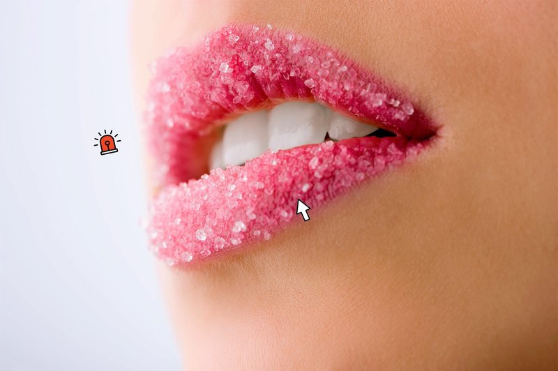 So tudi tebi to zimo ustnice čisto RAZPOKALE? Poskusi TO (+ čemu se IZOGIBAJ) (foto: Profimedia, Obdelava: Cosmo uredništvo)