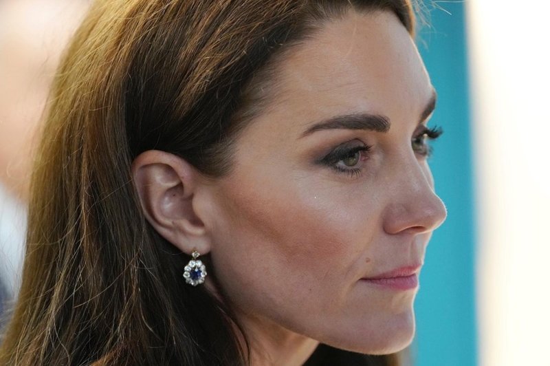 Palača o zdravstvenem stanju Kate Middleton tokrat razkrila presenetljivo veliko (foto: Profimedia)