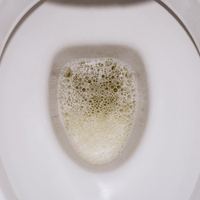 V WC školjko nasujte 50 g tega praška – učinek je skoraj neverjeten