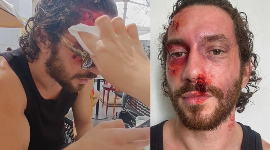 Dina (Skrito v raju) med počinicami v Makarski okrvavljenega posneli v baru (VIDEO) (foto: Instagram.com/martinoantulic)