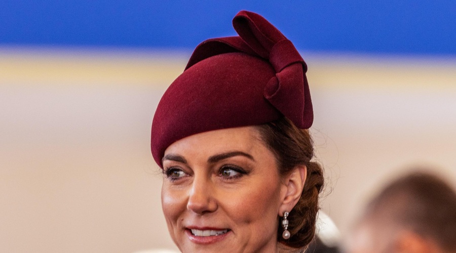 FOTO: Princesa Kate ima na glavi skrivnostno brazgotino, ki je posledica ... (foto: Profimedia)