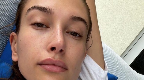 OMG! Hailey Bieber nas je končno presenetila z izdajo novega produkta Rhode