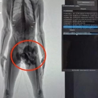 Cariniki na letališču zaustavili moškega in žensko: nihče ni mogel verjeti, kaj sta skrivala v spodnjicah (FOTO)