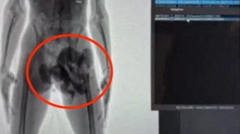 Cariniki na letališču zaustavili moškega in žensko: nihče ni mogel verjeti, kaj sta skrivala v spodnjicah (FOTO)