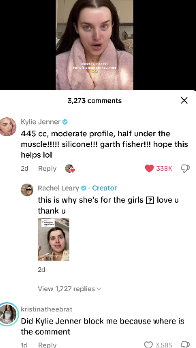Kylie Jenner končno razkrila lepotne popravke: iskrenost ali nova marketinška strategija?