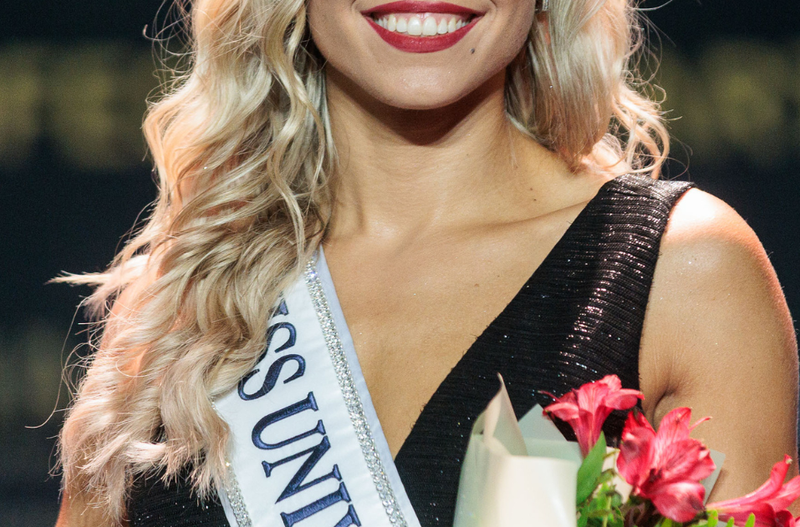 Imamo novo najlepšo Slovenko: kako izgleda 29-letna doktorica dentalne medicine, na kateri je nekaj še posebej izstopalo? (FOTO)