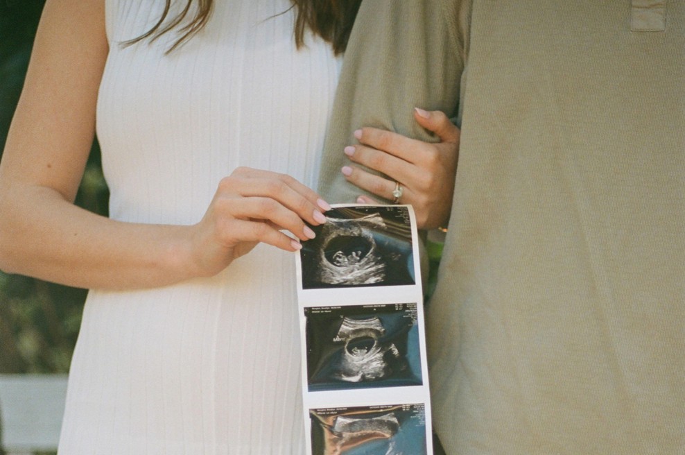 "Moja noseča cimra me je poskušala vreči iz stanovanja, a ni bila pripravljena na moj naslednji korak" (izpoved) (foto: Unsplash)