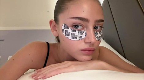 punca leži na postelji