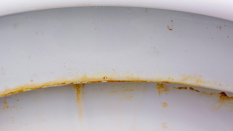 Kako za vedno odstraniti rumene madeže v WC školjki? To je trik naših babic, ki nadomesti vsa draga čistila