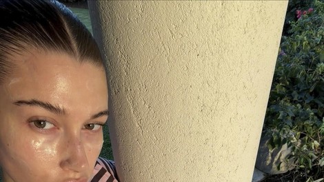 hailey bieber koža sonce ženska