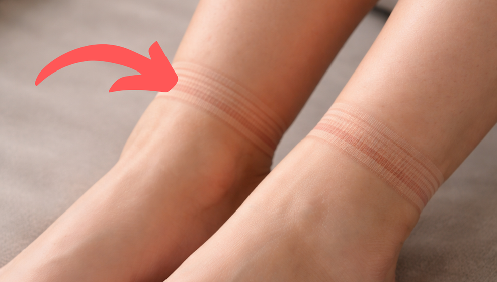 Zakaj se vam na gležnjih poznajo "ureznine" od nogavic? (foto: Cosmopolitan uredništvo)