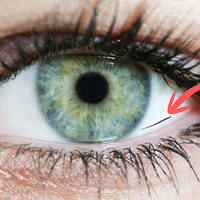 Kam grejo trepalnice, ki izginejo v vašem očesu?