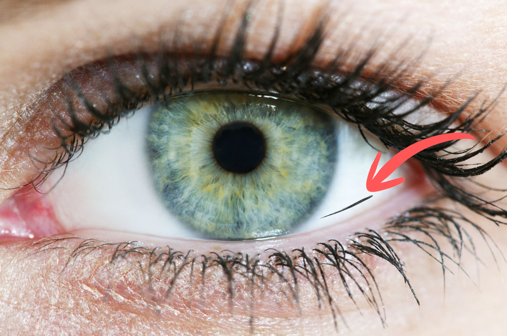 Kam grejo trepalnice, ki izginejo v vašem očesu? (foto: Profimedia, Obdelava: Cosmo uredništvo)