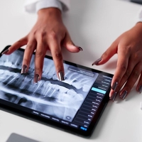 Rentgenska slika je šokirala zobozdravnike, prizor pa je podrl Guinnessov rekord