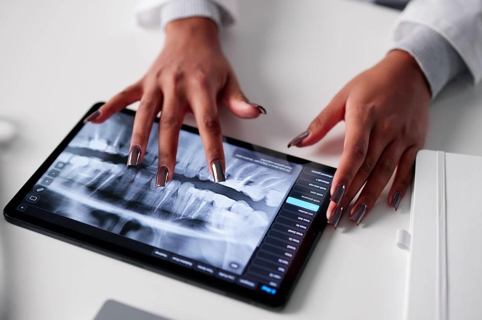 Rentgenska slika je šokirala zobozdravnike, prizor pa je podrl Guinnessov rekord (foto: profimedia)