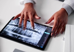 Rentgenska slika je šokirala zobozdravnike, prizor pa je podrl Guinnessov rekord