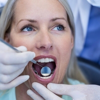 Zobozdravnik lahko vidi, če si izvajala oralni seks (to so znaki, ki te izdajo)