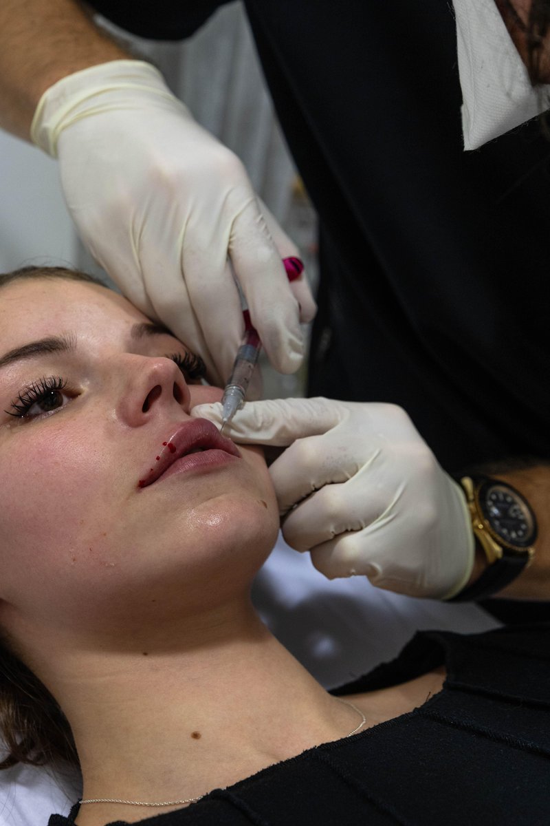 »Moj cilj ni, da je vidno, da ste bili pri meni.« Dr. Miha Verdnik o botoksu, polnilih, sodobnih estetskih posegih in najboljši poti do naravne lepote